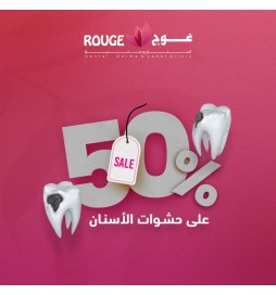 حشوات الأسنان خصم 50%
